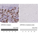 GPR182 Antibody in Immunohistochemistry (Paraffin) (IHC (P))