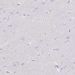 GPR182 Antibody in Immunohistochemistry (Paraffin) (IHC (P))