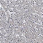 Cytokeratin 20 Antibody in Immunohistochemistry (Paraffin) (IHC (P))