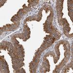 OXR1 Antibody in Immunohistochemistry (Paraffin) (IHC (P))