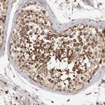 OXR1 Antibody in Immunohistochemistry (Paraffin) (IHC (P))