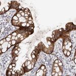 FAS Antibody in Immunohistochemistry (Paraffin) (IHC (P))