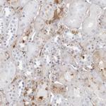 Fibrinogen gamma Antibody in Immunohistochemistry (Paraffin) (IHC (P))