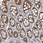 Bax Antibody in Immunohistochemistry (Paraffin) (IHC (P))