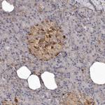 Bax Antibody in Immunohistochemistry (Paraffin) (IHC (P))