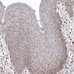 Bax Antibody in Immunohistochemistry (Paraffin) (IHC (P))