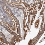 CPT2 Antibody in Immunohistochemistry (Paraffin) (IHC (P))