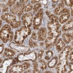 CPT2 Antibody in Immunohistochemistry (Paraffin) (IHC (P))