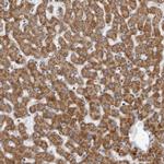 CPT2 Antibody in Immunohistochemistry (Paraffin) (IHC (P))