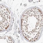 HSP105 Antibody in Immunohistochemistry (Paraffin) (IHC (P))