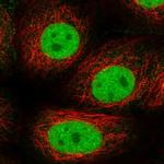 GTF2F1 Antibody in Immunocytochemistry (ICC/IF)