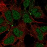 JAM2 Antibody in Immunocytochemistry (ICC/IF)