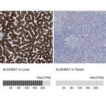 ALDH6A1 Antibody in Immunohistochemistry (Paraffin) (IHC (P))