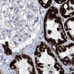 ALDH6A1 Antibody in Immunohistochemistry (Paraffin) (IHC (P))