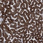 ALDH6A1 Antibody in Immunohistochemistry (Paraffin) (IHC (P))