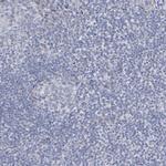 ALDH6A1 Antibody in Immunohistochemistry (Paraffin) (IHC (P))