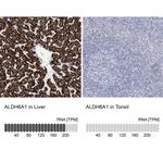 ALDH6A1 Antibody in Immunohistochemistry (Paraffin) (IHC (P))