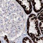 ALDH6A1 Antibody in Immunohistochemistry (Paraffin) (IHC (P))