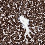 ALDH6A1 Antibody in Immunohistochemistry (Paraffin) (IHC (P))