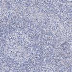 ALDH6A1 Antibody in Immunohistochemistry (Paraffin) (IHC (P))