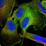 TGM2 Antibody in Immunocytochemistry (ICC/IF)