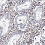 TGM2 Antibody in Immunohistochemistry (Paraffin) (IHC (P))