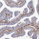 TGM2 Antibody in Immunohistochemistry (Paraffin) (IHC (P))