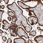 TGM2 Antibody in Immunohistochemistry (Paraffin) (IHC (P))