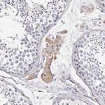 TGM2 Antibody in Immunohistochemistry (Paraffin) (IHC (P))