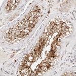 CAR Antibody in Immunohistochemistry (Paraffin) (IHC (P))