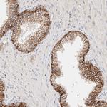 CAR Antibody in Immunohistochemistry (Paraffin) (IHC (P))