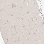 CAR Antibody in Immunohistochemistry (Paraffin) (IHC (P))