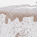 CAR Antibody in Immunohistochemistry (Paraffin) (IHC (P))