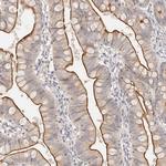 CAR Antibody in Immunohistochemistry (Paraffin) (IHC (P))