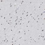 BMI-1 Antibody in Immunohistochemistry (Paraffin) (IHC (P))