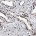 BMI-1 Antibody in Immunohistochemistry (Paraffin) (IHC (P))