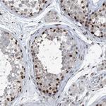 BMI-1 Antibody in Immunohistochemistry (Paraffin) (IHC (P))