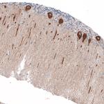 Jagged2 Antibody in Immunohistochemistry (Paraffin) (IHC (P))