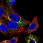 Albumin Antibody in Immunocytochemistry (ICC/IF)