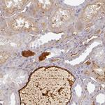 Albumin Antibody in Immunohistochemistry (Paraffin) (IHC (P))