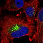 CTGF Antibody in Immunocytochemistry (ICC/IF)