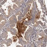 CTGF Antibody in Immunohistochemistry (Paraffin) (IHC (P))