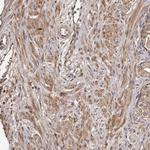 CTGF Antibody in Immunohistochemistry (Paraffin) (IHC (P))