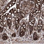 SEMA6A Antibody in Immunohistochemistry (Paraffin) (IHC (P))