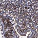 ABCG1 Antibody in Immunohistochemistry (Paraffin) (IHC (P))