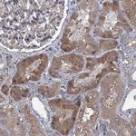 ABCG1 Antibody in Immunohistochemistry (Paraffin) (IHC (P))