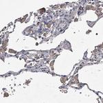 ABCG1 Antibody in Immunohistochemistry (Paraffin) (IHC (P))