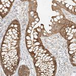 MIPEP Antibody in Immunohistochemistry (Paraffin) (IHC (P))