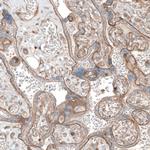 Laminin alpha-1 Antibody in Immunohistochemistry (Paraffin) (IHC (P))