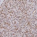 SP3 Antibody in Immunohistochemistry (Paraffin) (IHC (P))